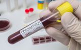 1583411089_coronavirus-urgence-mondiale-sante-oms.jpg